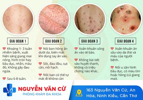 Xét Nghiệm Giang Mai Bằng Máu Là Gì? Đâu Là Phương Pháp Xét Nghiệm Hiệu Quả Nhất?