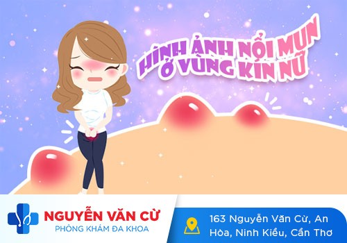Nổi Mụn Li Ti Ở Vùng Kín Là Bệnh Gì?