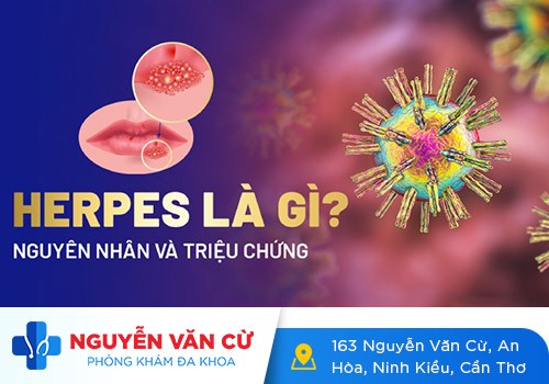 Thông tin về herpes sinh dục