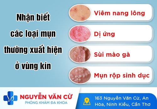 Nổi Mụn Bọc Ở Vùng Kín Có Sao Không?