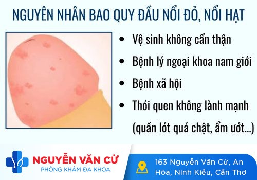 Bao quy đầu nổi đỏ, bao quy đầu nổi hạt có sao không?