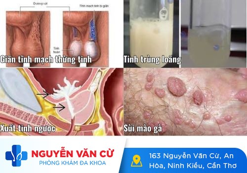 Vô sinh hiếm muộn, nguyên nhân do đâu?