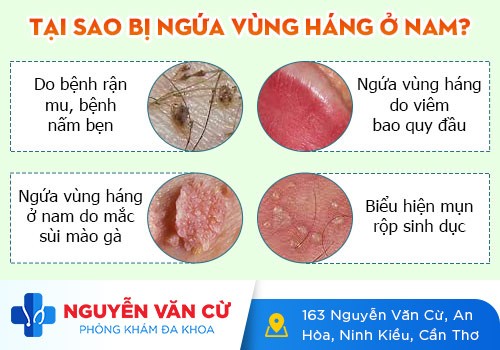 Ngứa Ngáy Vùng Kín Nam – Triệu Chứng Bệnh Nam Khoa Thường Gặp