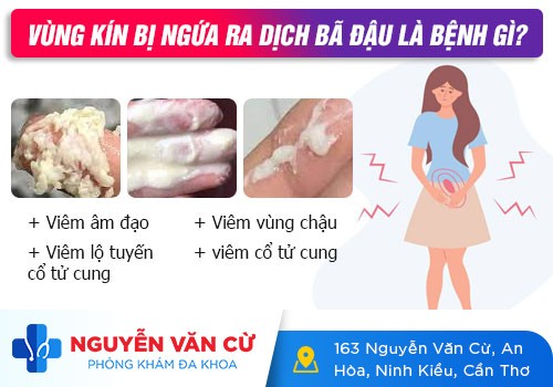 Bị Ngứa 2 Bên Mép Vùng Kín Là Dấu Hiệu Của Bệnh Gì?