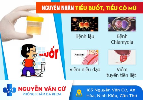 Đi Đái Ra Mủ Là Bị Bệnh Gì?
