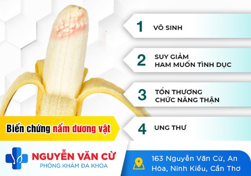 Cảnh giác với tình trạng nấm dương vật