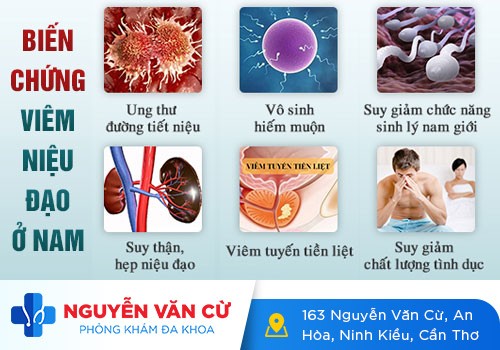 Ngứa lỗ tiểu, ngứa ống dẫn đường tiểu ở nam