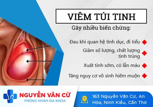 Bệnh viêm túi tinh và những điều cần biết