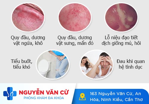 Dương vật nặng mùi là bị sao?