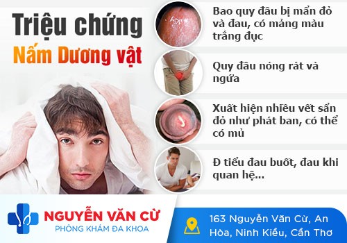 Các cách điều trị nấm dương vật được bác sĩ khuyên dùng
