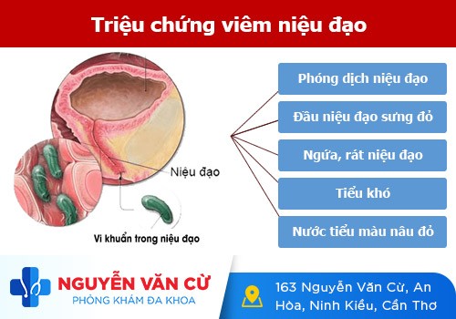 Viêm niệu đạo và những điều cả nam lẫn nữ giới cần phải biết
