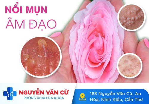 Nguyên Nhân Gây Ra Mụn Mủ Ở Vùng Kín