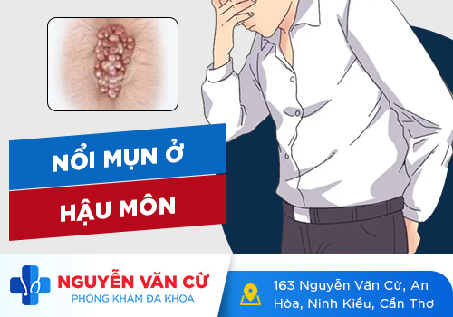 Hậu Môn Nổi Mụn Thịt Và Ngứa Là Bệnh Gì? Cách Điều Trị?