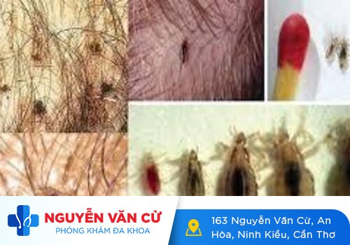 Thuốc trị rận mu loại nào tốt và hiệu quả?