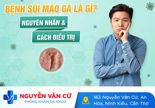 Sùi Mào Gà: Dấu Hiệu, Nguyên Nhân Và Cách Điều Trị Hiệu Quả