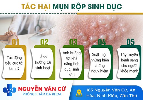 Tổng Quan Về Mụn Rộp Sinh Dục – Nguyên Nhân Và Cách Điều Trị Hiệu Quả