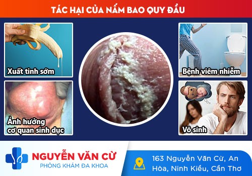 Bao Quy Đầu Bị Loét: Dấu Hiệu Bệnh Lý Nam Khoa Nguy Hiểm