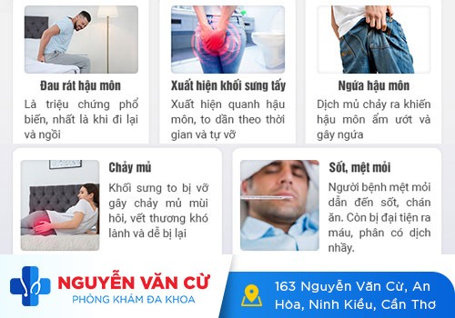 Dấu hiệu nhận biết và cách chữa áp xe hậu môn hiệu quả
