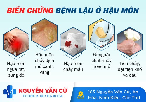 Dấu Hiệu Bệnh Lậu Ở Hậu Môn – Nguyên Nhân Và Cách Điều Trị Hiệu Quả