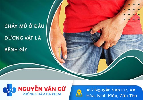 Cậu Nhỏ Bị Chảy Mủ: Nguyên Nhân Và Cách Điều Trị Tại Nhà