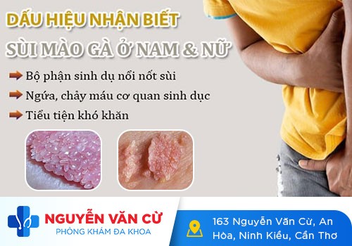 Dấu Hiệu Nhận Biết Ban Đầu Của Bệnh Sùi Mào Gà