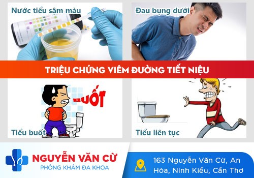 Dấu hiệu viêm đường tiểu và cách điều trị hiệu quả