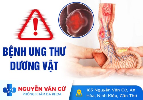 Ung Thư Dương Vật Có Triệu Chứng Như Thế Nào?